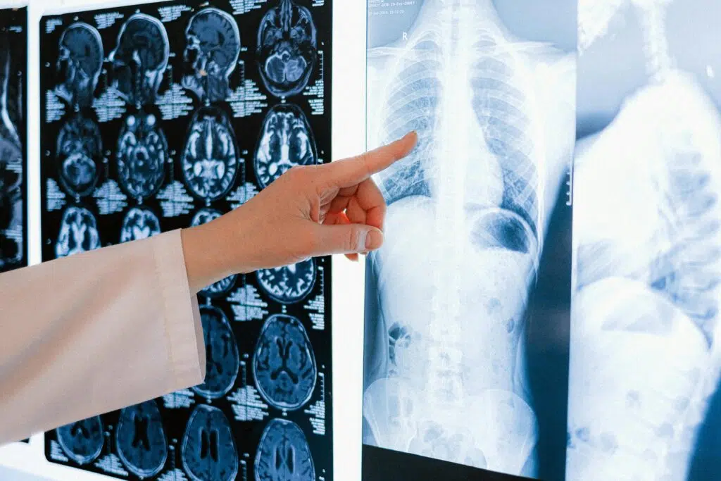 Best Foods for Brain Health and Memory