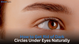 How to Get Rid of Dark Circles Under Eyes Naturally